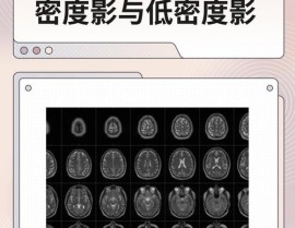 开源ct,推进医学印象技能的立异与展开