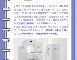 什么是开源ct,什么是开源CT？